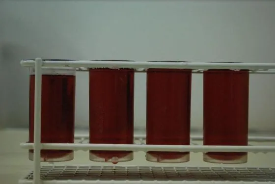 campioni di vino frizzante pronti per degasificazione con bagno ad ultrasuoni