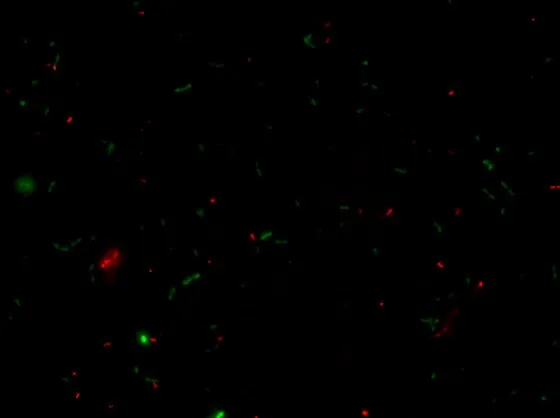 Batteri vivi e morti